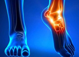 Consejos para prevenir lesiones de pie y tobillo salud pies tobillos 324x235 Home